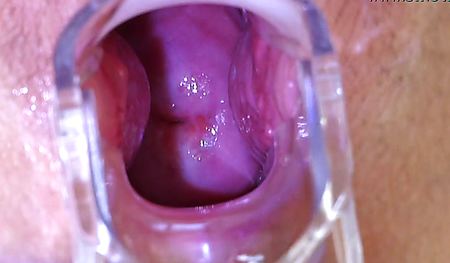 Девушка засветила матку на приеме